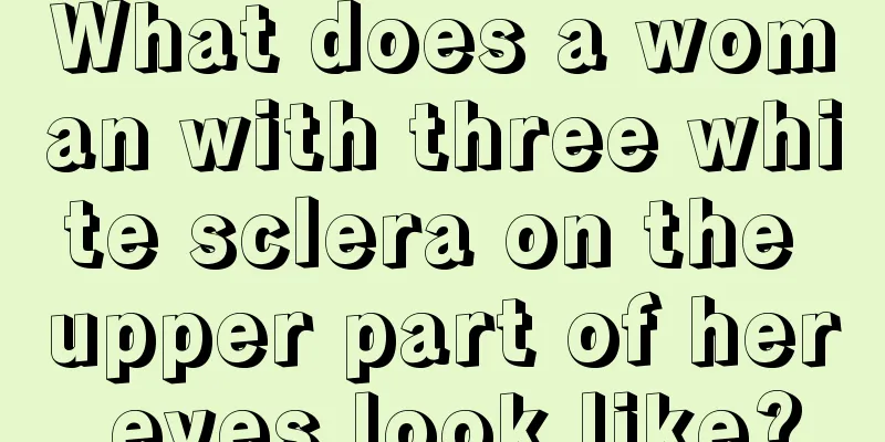 What does a woman with three white sclera on the upper part of her eyes look like?