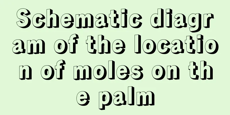 Schematic diagram of the location of moles on the palm
