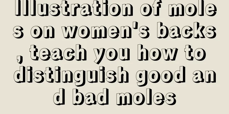 Illustration of moles on women's backs, teach you how to distinguish good and bad moles