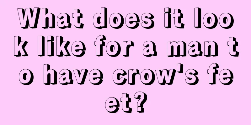 What does it look like for a man to have crow's feet?