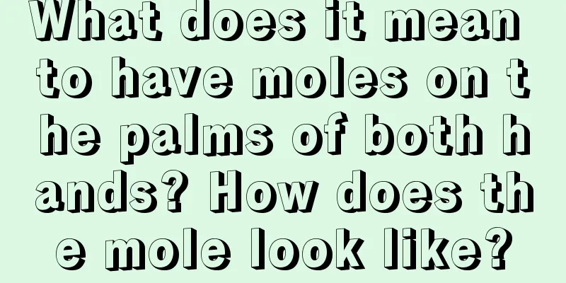 What does it mean to have moles on the palms of both hands? How does the mole look like?