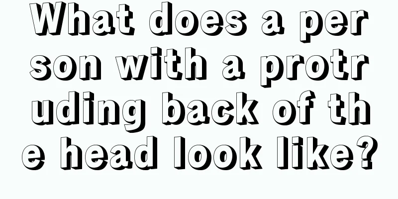 What does a person with a protruding back of the head look like?