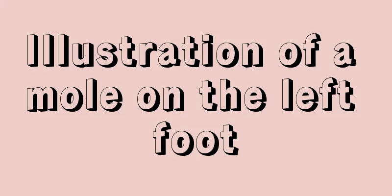 Illustration of a mole on the left foot