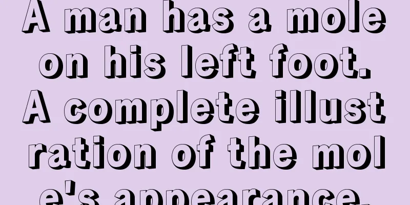 A man has a mole on his left foot. A complete illustration of the mole's appearance.