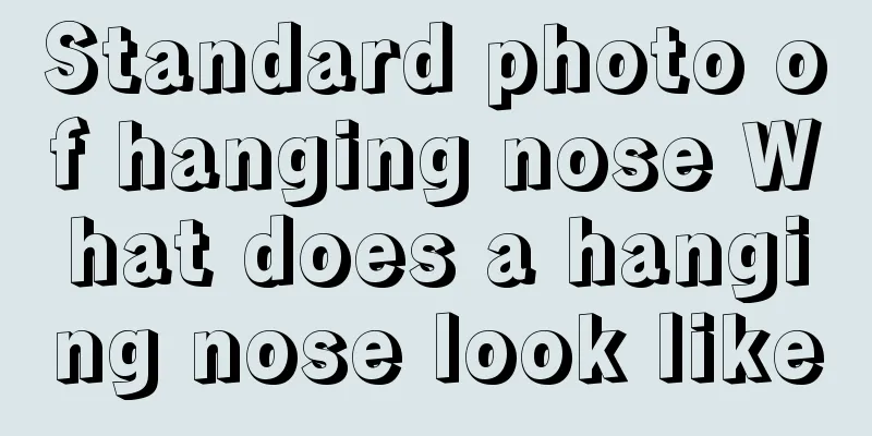 Standard photo of hanging nose What does a hanging nose look like