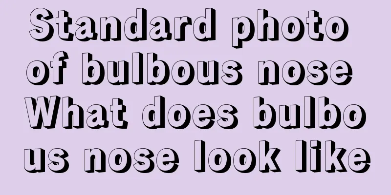 Standard photo of bulbous nose What does bulbous nose look like