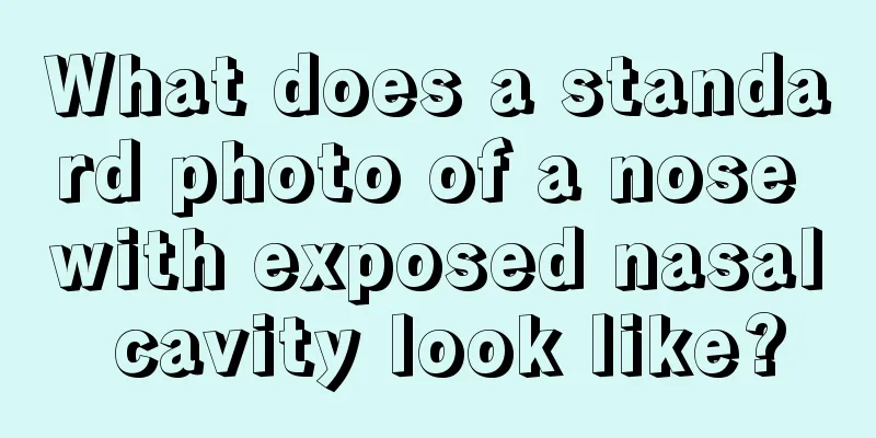 What does a standard photo of a nose with exposed nasal cavity look like?