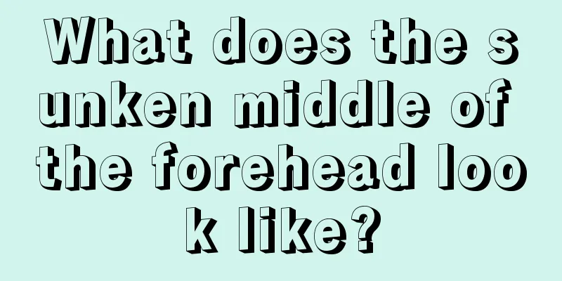What does the sunken middle of the forehead look like?