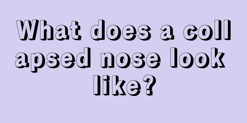 What does a collapsed nose look like?