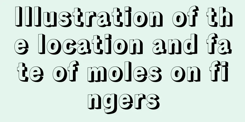 Illustration of the location and fate of moles on fingers