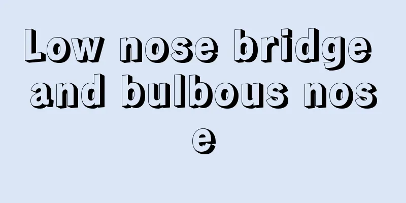 Low nose bridge and bulbous nose