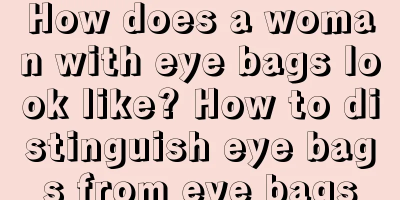How does a woman with eye bags look like? How to distinguish eye bags from eye bags
