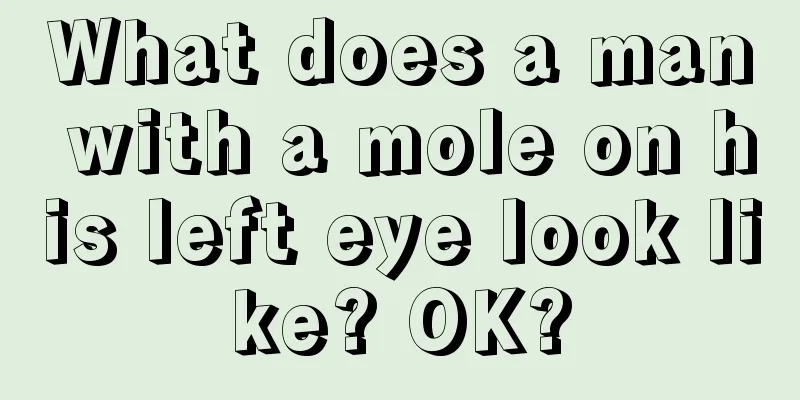 What does a man with a mole on his left eye look like? OK?