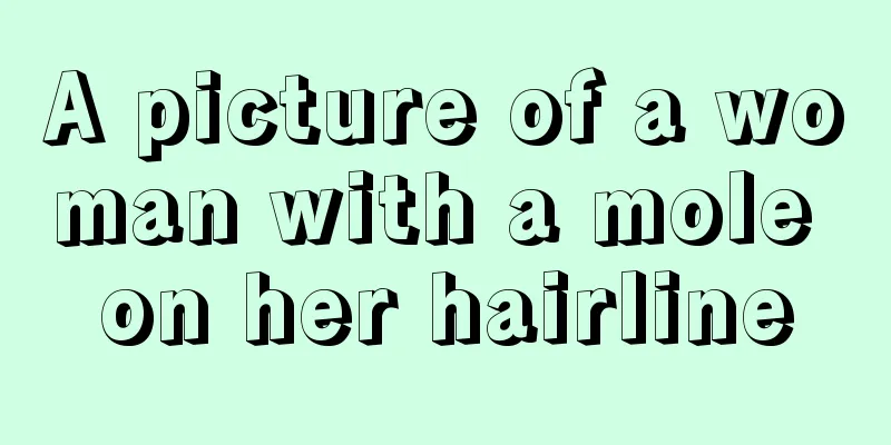 A picture of a woman with a mole on her hairline