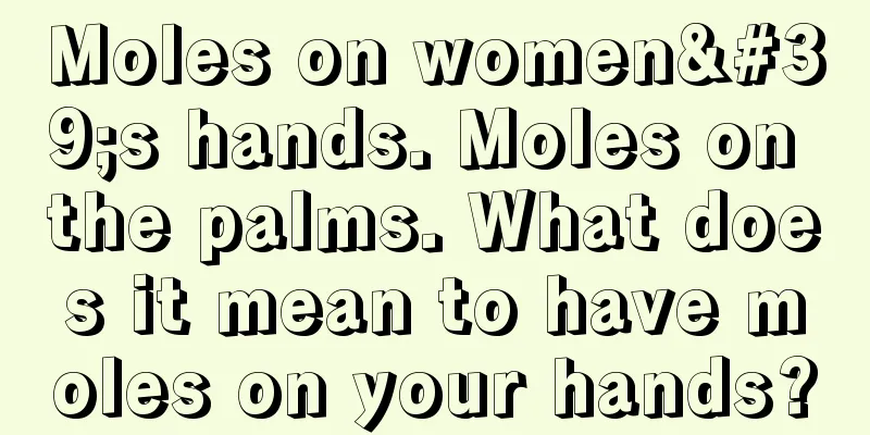 Moles on women's hands. Moles on the palms. What does it mean to have moles on your hands?