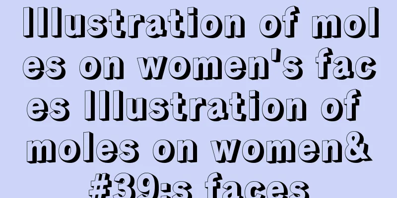 Illustration of moles on women's faces Illustration of moles on women's faces