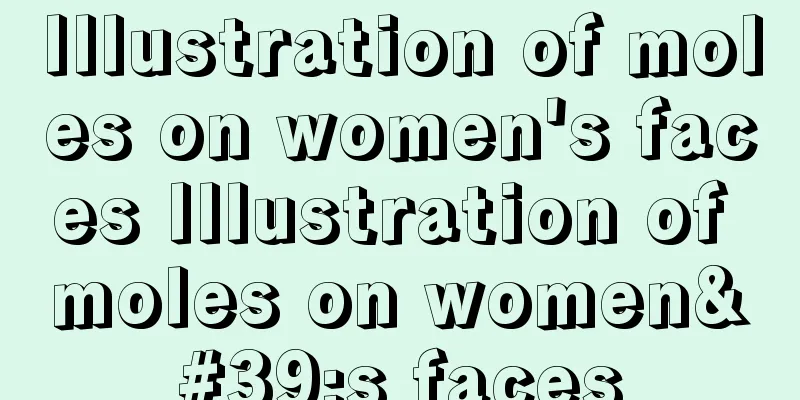 Illustration of moles on women's faces Illustration of moles on women's faces