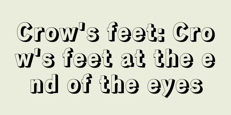 Crow's feet: Crow's feet at the end of the eyes