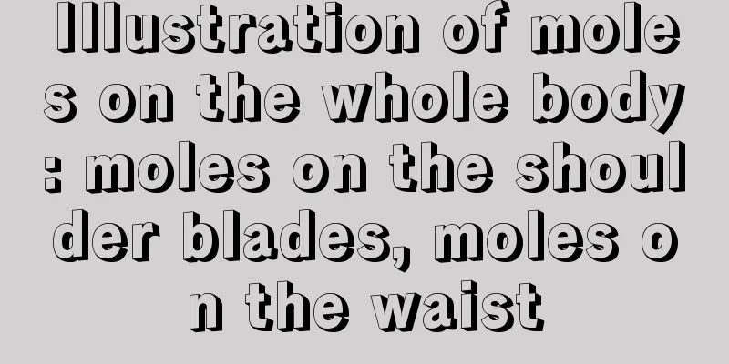 Illustration of moles on the whole body: moles on the shoulder blades, moles on the waist
