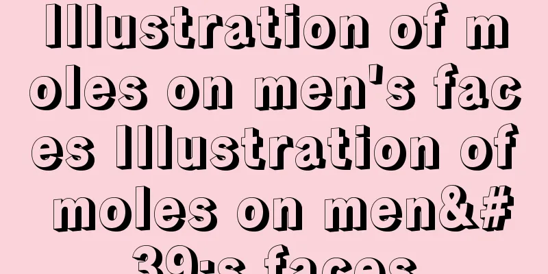 Illustration of moles on men's faces Illustration of moles on men's faces