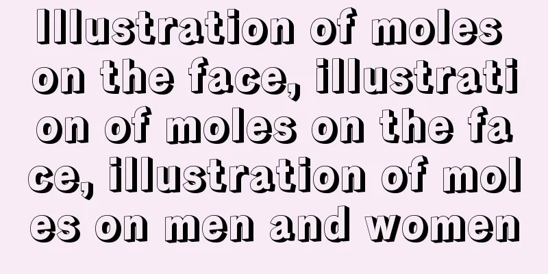 Illustration of moles on the face, illustration of moles on the face, illustration of moles on men and women