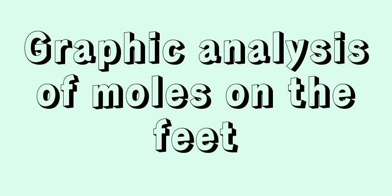 Graphic analysis of moles on the feet