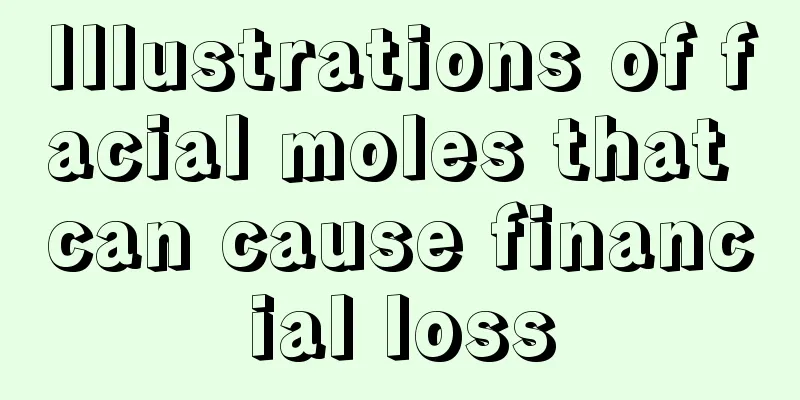 Illustrations of facial moles that can cause financial loss