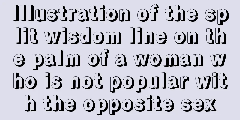 Illustration of the split wisdom line on the palm of a woman who is not popular with the opposite sex