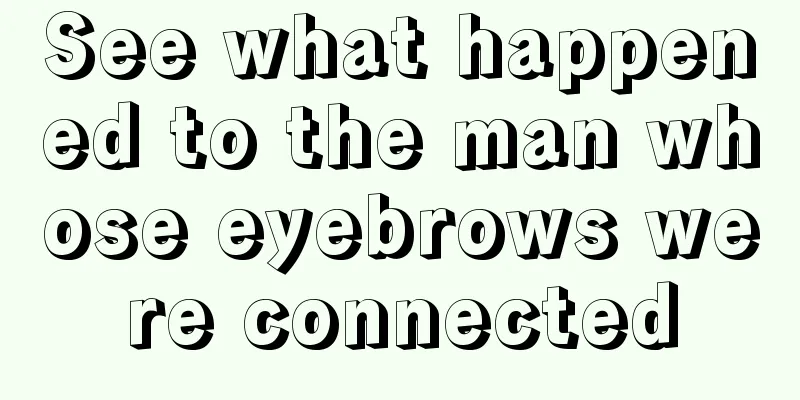 See what happened to the man whose eyebrows were connected