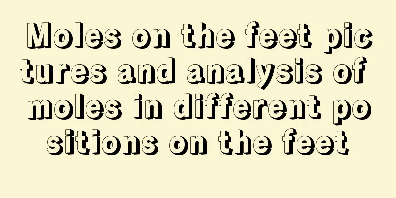 Moles on the feet pictures and analysis of moles in different positions on the feet