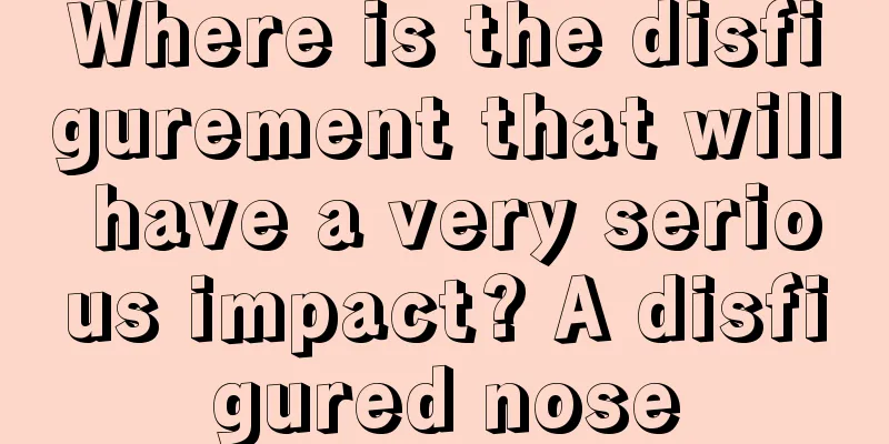 Where is the disfigurement that will have a very serious impact? A disfigured nose