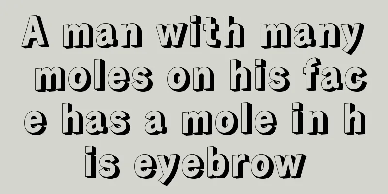 A man with many moles on his face has a mole in his eyebrow