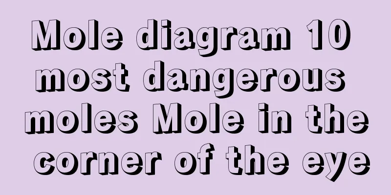 Mole diagram 10 most dangerous moles Mole in the corner of the eye