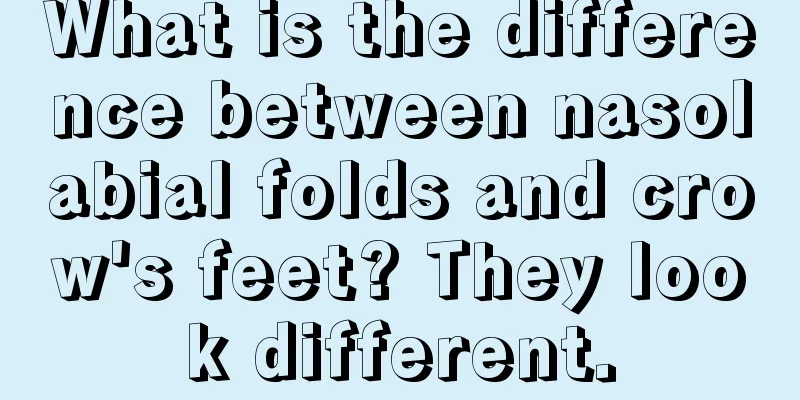 What is the difference between nasolabial folds and crow's feet? They look different.