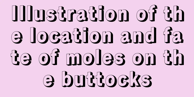 Illustration of the location and fate of moles on the buttocks