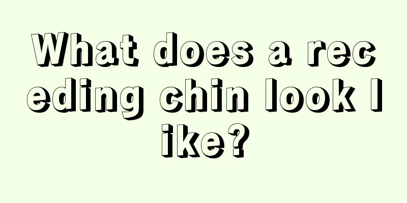 What does a receding chin look like?
