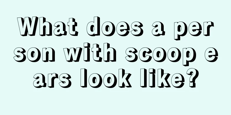 What does a person with scoop ears look like?