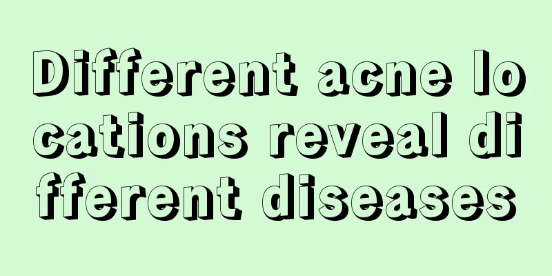 Different acne locations reveal different diseases