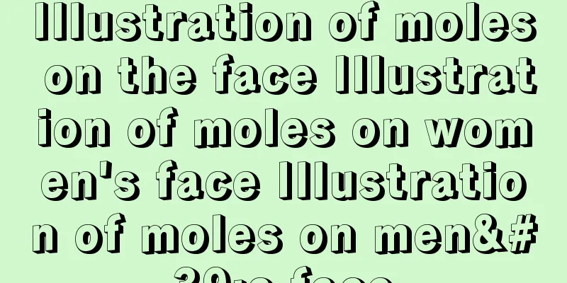 Illustration of moles on the face Illustration of moles on women's face Illustration of moles on men's face