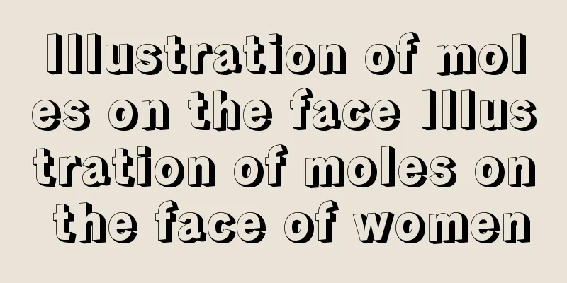Illustration of moles on the face Illustration of moles on the face of women
