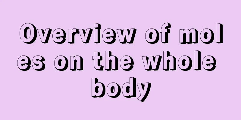 Overview of moles on the whole body