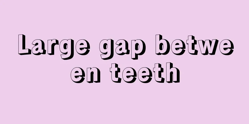 Large gap between teeth