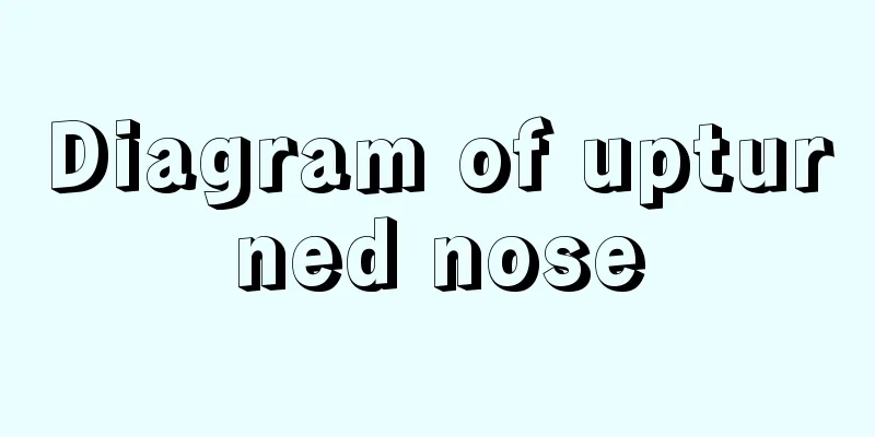 Diagram of upturned nose