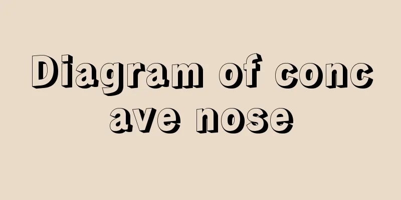 Diagram of concave nose