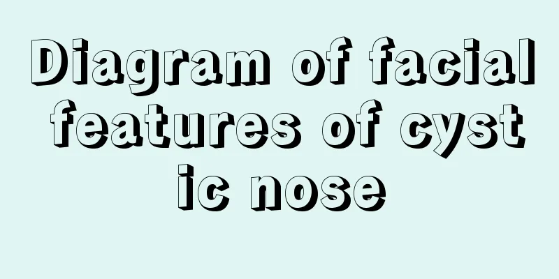 Diagram of facial features of cystic nose