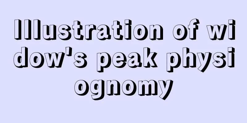 Illustration of widow's peak physiognomy