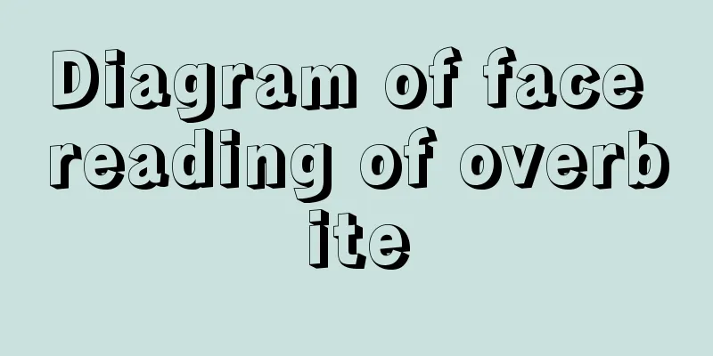 Diagram of face reading of overbite