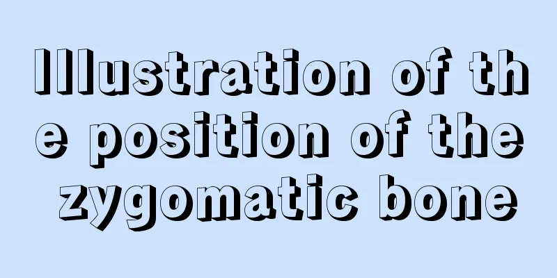 Illustration of the position of the zygomatic bone