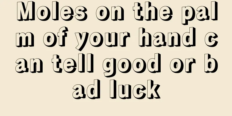 Moles on the palm of your hand can tell good or bad luck