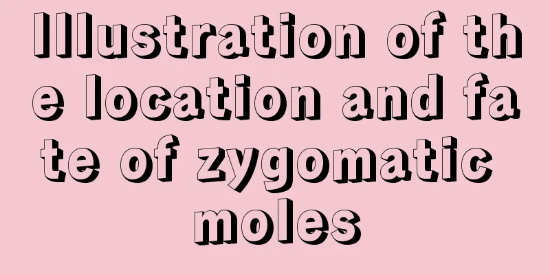 Illustration of the location and fate of zygomatic moles
